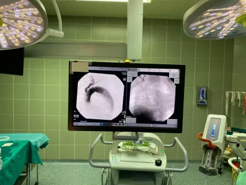 Endovaskularni tim Zavoda za vaskularnu kirurgiju Kliničkog bolničkog centra Osijek prvi je put izveo zahvat ugradnje GORE TAG TBE (Thoracic Branch Endoprosthesis)Osijek srpanj 2024.Foto: KBCO/ustupljena