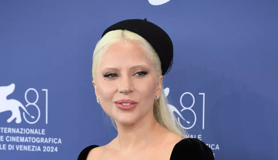 Lady Gaga attends the "Joker: Folie A Deux" photocall during the 81st Venice International Film Festival at Palazzo del Casino in Venice. (Photo by Luigi Lorio/SOPA Images/Sipa USA) Photo: SOPA Images/SIPA USA