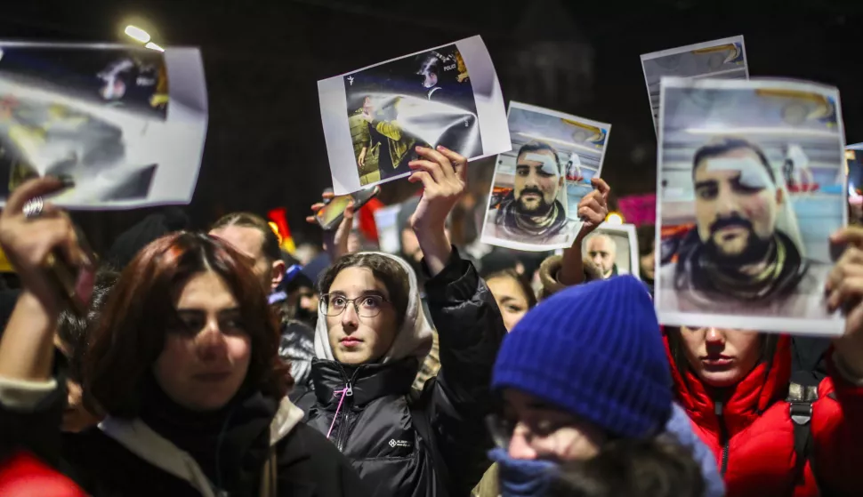 epa11776935 Supporters of the Georgian opposition hold portraits of people injured at rallies during a protest after Mikheil Kavelashvili is elected as new Georgia's President following voting at the Parliament building during presidential elections in Tbilisi, Georgia, 14 December 2024. For the first time in Georgia, the president is being elected by an electoral college in the parliament building. President Salome Zourabichvili, declaring herself the only lawful representative of power in the country, said that she would not resign from her post, stating that 'with an illegitimate parliament, there cannot be legitimate presidential elections'. EPA/DAVID MDZINARISHVILI