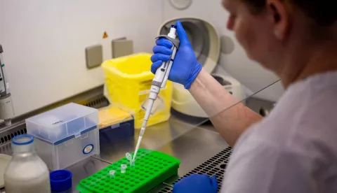 epa12017398 A laboratory technician works on milk samples at the State Veterinary Institute in PCR laboratory in Olomouc, Czech Republic, 08 April 2025. Due to the risk of foot-and-mouth disease spreading, which has appeared on farms in Slovakia and Hungary, the Institute tests milk samples from selected farms by the veterinary administration, which are located near the Slovak border or in locations where there could be an increased risk of virus transmission. So far, the disease has not appeared on Czech territory. EPA/MARTIN DIVISEK