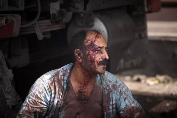 epa12056412 GRAPHIC CONTENT - An injured worker rests near the site of an explosion at the Rajaie port in the city of Bandar Abbas, southern Iran, 26 April 2025. Iranian state media reported on 26 April several injuries in an explosion at the port, but authorities have not yet announced the cause. EPA/Mohammad Rasoul Moradi -- ATTENTION EDITORS: GRAPHIC CONTENT --