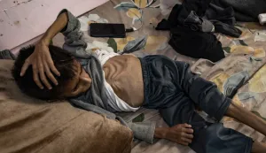 epaselect epa12137109 Five-year-old Palestinian child Osama al-Raqab, who is suffering from severe malnutrition receives treatment at Nasser Hospital in Khan Yunis, southern Gaza Strip, 26 May 2025. EPA/HAITHAM IMAD