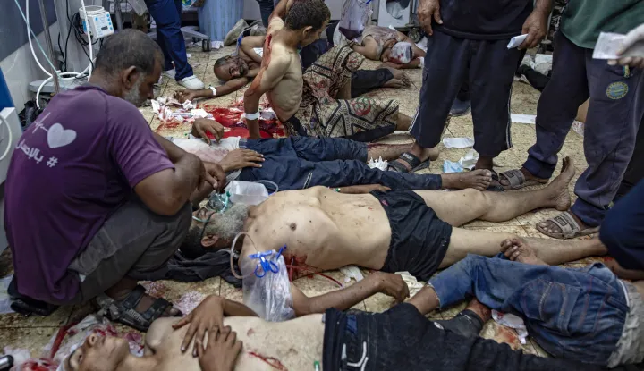 epa12284565 GRAPHIC CONTENT - Wounded Palestinians are treated at Nasser Hospital in Khan Younis, Gaza Strip, 05 August 2025. According to the hospital, hundreds of patients were being treated following Israeli bombardements on a near-by area. EPA/HAITHAM IMAD -- ATTENTION EDITORS: GRAPHIC CONTENT --