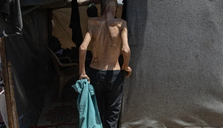 epa12281891 Internally displaced elderly Palestinian man Salim Asfour, enters his family's tent in Khan Younis, southern Gaza Strip, 03 August 2025. Salim, 85, suffers from severe malnutrition, which in recent months has led to the loss of over 40 kilograms of his body weight. When food is available, Salim gives most of his rations to his family, and his advanced age makes him more vulnerable to the effects of malnutrition. More than 170 Palestinians, the majority of whom children, have died of malnutrition in Gaza since Israel blocked all supplies from entering the Strip in March 2025, the Palestinian Ministry of Health said on 03 August. EPA/HAITHAM IMAD