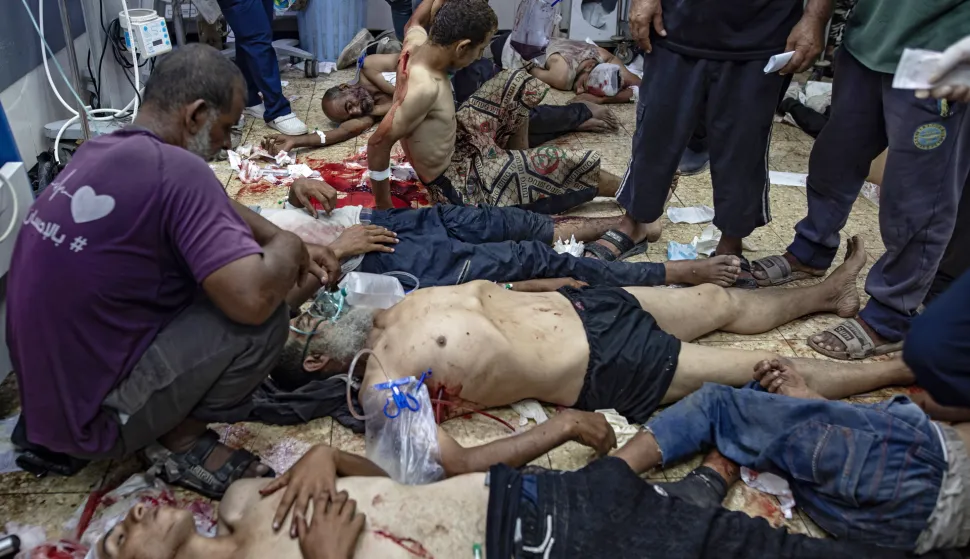 epa12284565 GRAPHIC CONTENT - Wounded Palestinians are treated at Nasser Hospital in Khan Younis, Gaza Strip, 05 August 2025. According to the hospital, hundreds of patients were being treated following Israeli bombardements on a near-by area. EPA/HAITHAM IMAD -- ATTENTION EDITORS: GRAPHIC CONTENT --