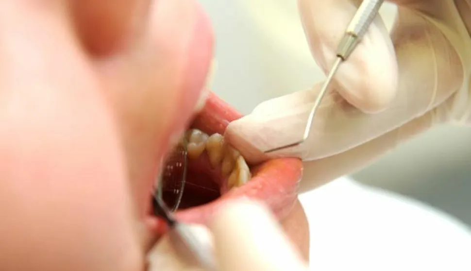 RIJEKA 28.03.2013. NOVOSTIZUBARSKA ORDINACIJA,ZUBI, ZDRAVSTVO FISKALNA BLAGAJNA FOTO MARKO GRACIN 