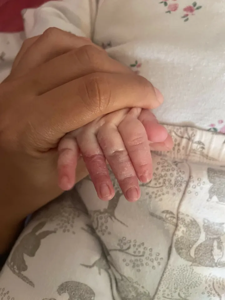 Marlena je beba leptir, jedina u Hrvatskoj. Njen osmijeh je dokaz da u najtežem danu postoji svjetlo