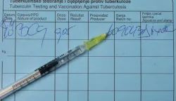 04.05.2022., Zagreb - Ilustracija - tuberkuloza.Photo: Davor Puklavec/PIXSELL Photo: Davor Puklavec/PIXSELL