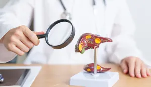 Brini o jetri danas - spriječi rak sutra: Masnu jetru ima 10 posto djece i 25 posto odraslih