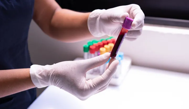 blood test krv