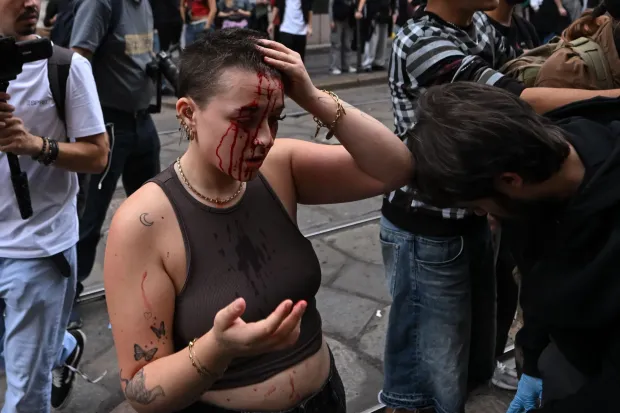 A demonstrator bleeds during clashes with Police at an anti-government protest organized by the Italia in Piazza movement, at Piazza Duomo in Milan, on October 17, 2026. Inspired by recent protests in France and Spain, demonstrators are protesting against the rising cost of living, low wages, high rents and public service shortcomings, demanding better living and working conditions. (Photo by Piero CRUCIATTI/AFP)
